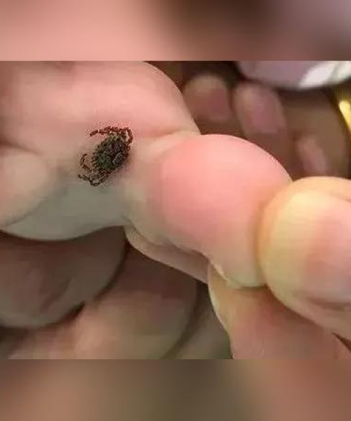 揭秘头晕恶心手发热背后的健康警示，百度带你了解症状真相